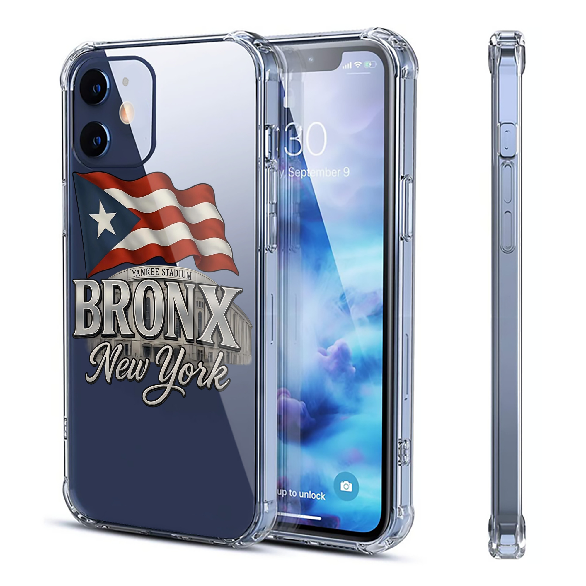 New York Yankees BRONX Yankees Stadium Clear IPhone 12 Case – Soft TPU With UV Print – Enhanced Drop Protection, Precise Fit, Anti-Fingerprint, Customizable Design, Scratch-Resistant, Yellow-Resistant